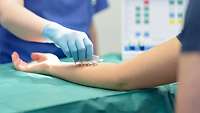 Allergietest in der Klinik für Dermatologie, Venerologie und Allergologie am Bundeswehrkrankenhaus Westerstede