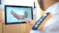 Digitales 3D Model eines Unterkiefers in der Klinik für Mund-, Kiefer- und Gesichtschirurgie am Bundeswehrkrankenhaus Ulm
