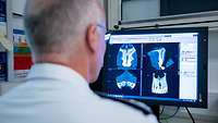 Ansicht eines Kiefers in 3D in der Klinik für Mund, Kiefer- und plastischen Gesichtschirurgie am Bundeswehrkrankenhaus Hamburg