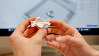 Modell eines Wirbelkörpers aus einem 3D-Drucker in der Klinik für Neurochirurgie am Bundeswehrkrankenhaus Westerstede