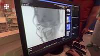 Auf einem Monitor wird eine Röntgenaufnahme eines Schädels gezeigt