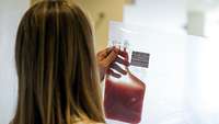 Kontrolle einer Stammzelltransfusion