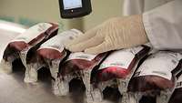 Abscannen von Bluttransfusionen